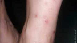 Flea And Tick Treatment For Your Beloved Pets